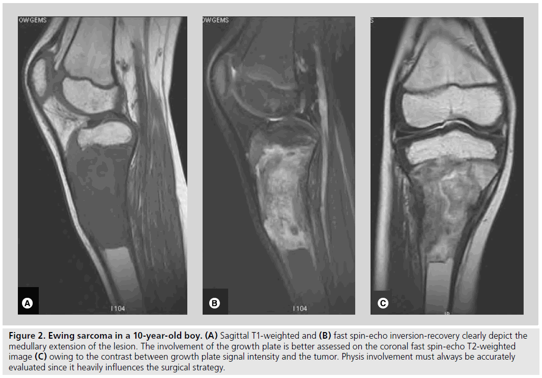 imaging-in-medicine-growth-plate