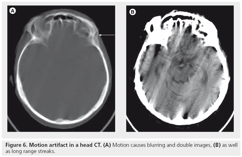 imaging-in-medicine-head-CT