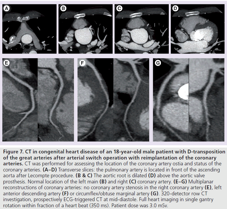 imaging-in-medicine-heart-disease