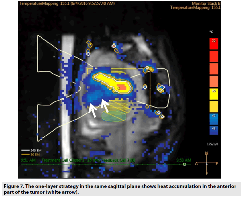 imaging-in-medicine-heat-accumulation