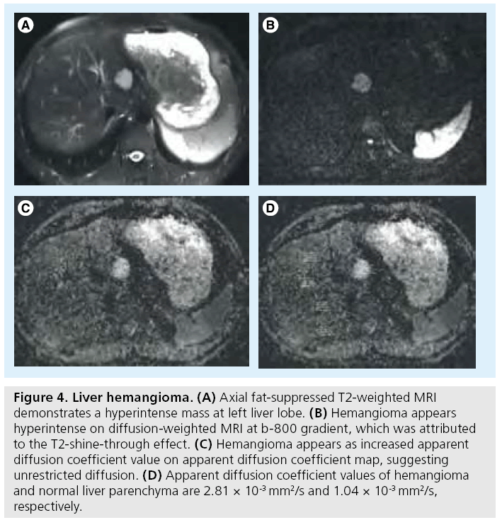 imaging-in-medicine-hemangioma