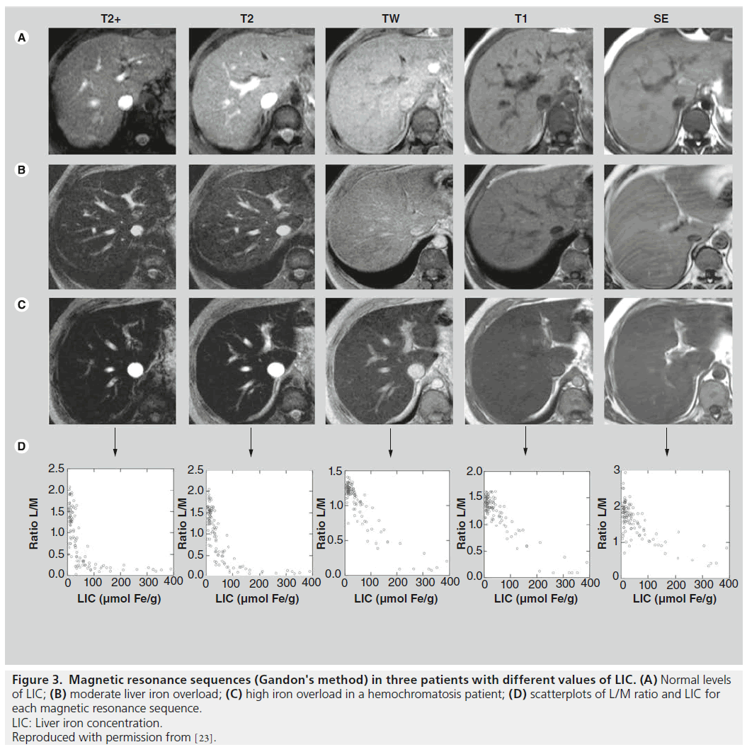 imaging-in-medicine-hemochromatosis-patient