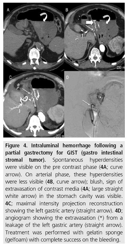 imaging-in-medicine-hemorrhage