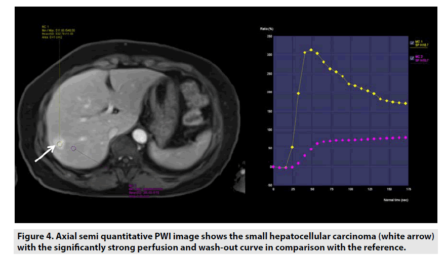 imaging-in-medicine-hepatocellular-carcinoma