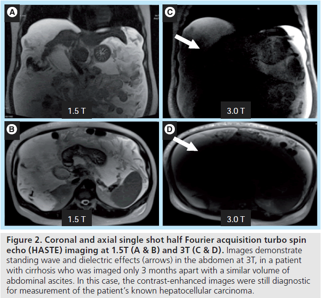 imaging-in-medicine-hepatocellular-carcinoma
