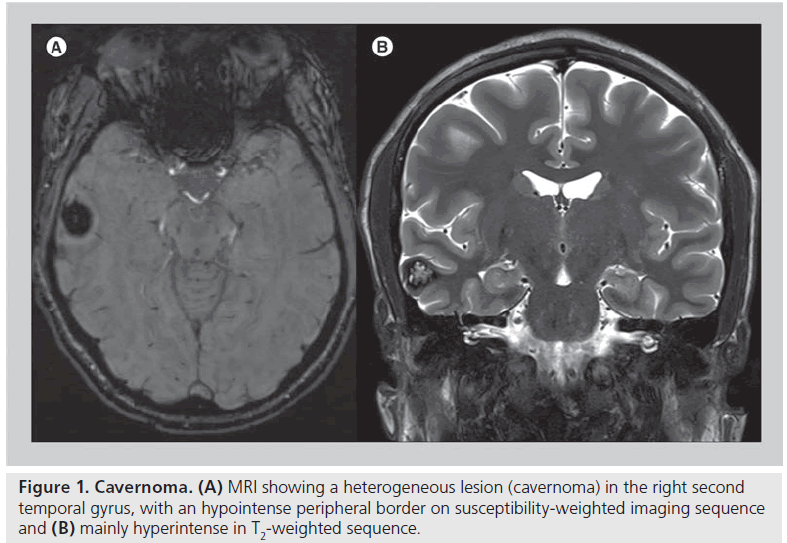 imaging-in-medicine-heterogeneous-lesion