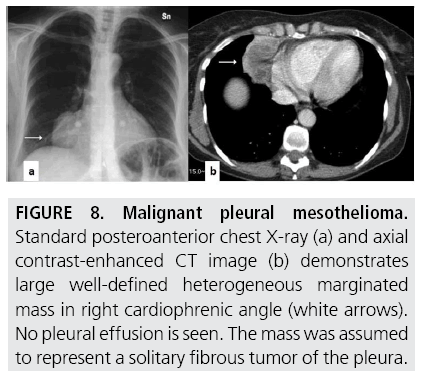 imaging-in-medicine-heterogeneous-marginated