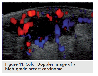imaging-in-medicine-high-grade