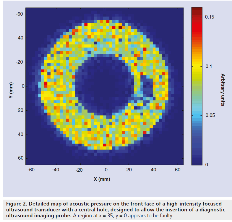imaging-in-medicine-high-intensity