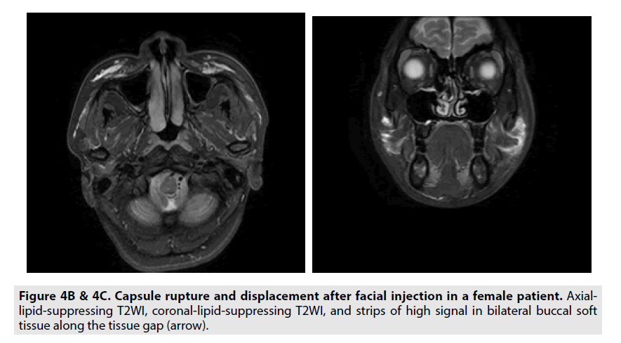 imaging-in-medicine-high-signal