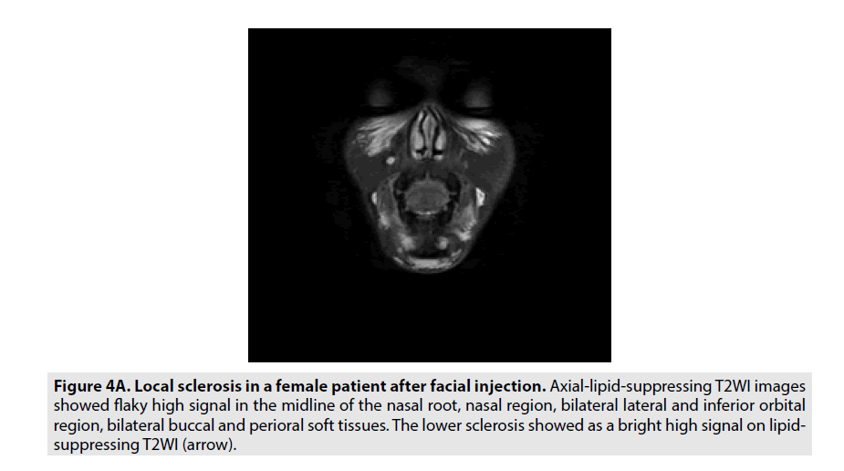 imaging-in-medicine-high-signal