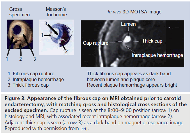 imaging-in-medicine-histological-cross