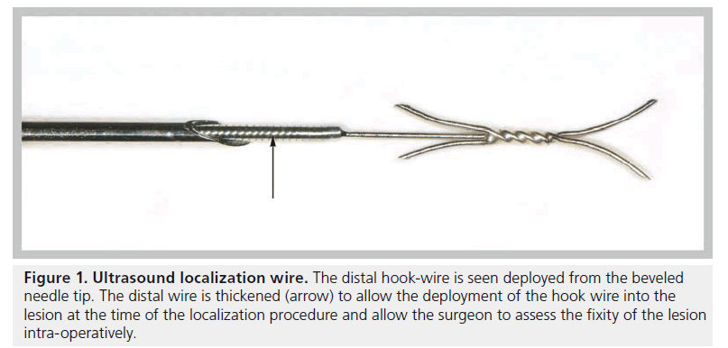 imaging-in-medicine-hook-wire