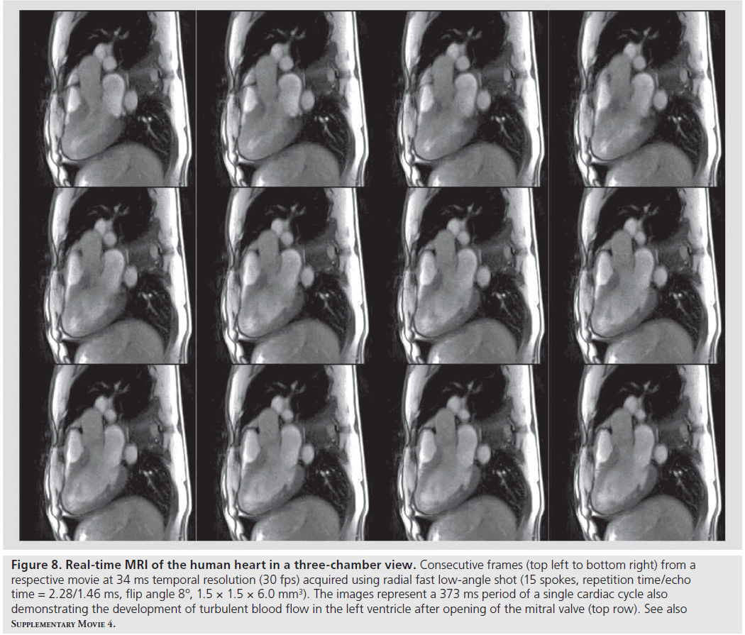 imaging-in-medicine-human-heart