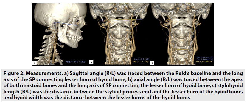 imaging-in-medicine-hyoid-bone