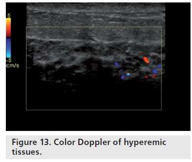 Doppler Ultrasound Color Chart