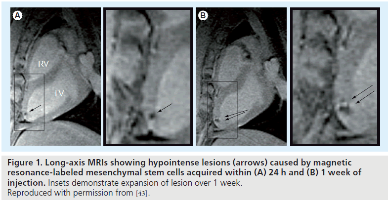 imaging-in-medicine-hypointense-lesions