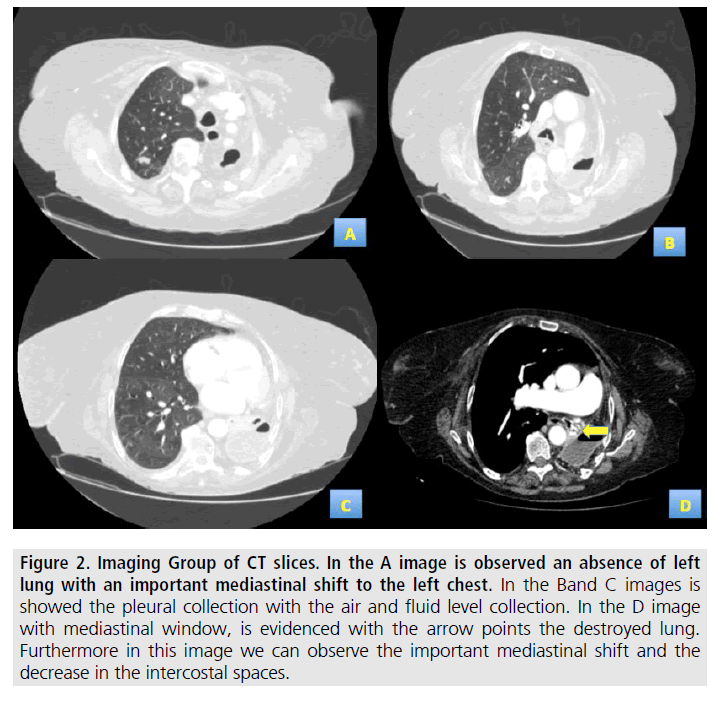 imaging-in-medicine-important-mediastinal