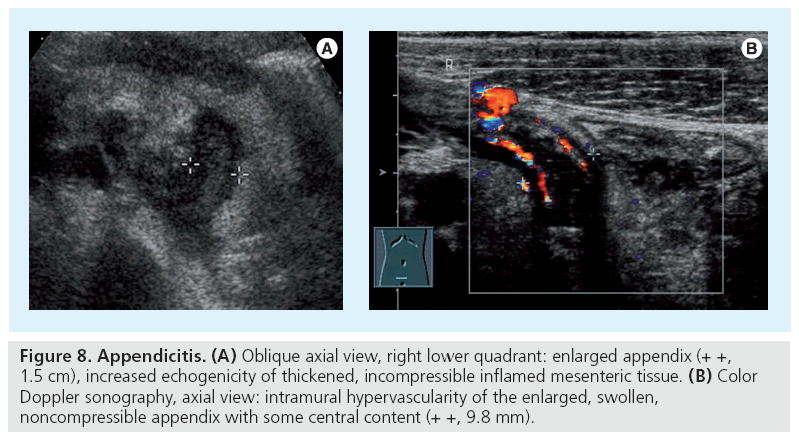 imaging-in-medicine-incompressible-inflamed