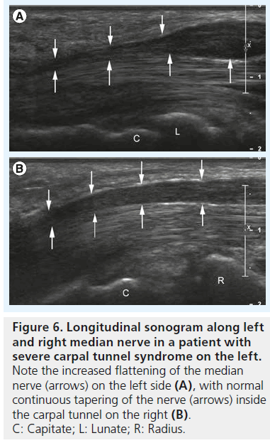 imaging-in-medicine-increased-flattening