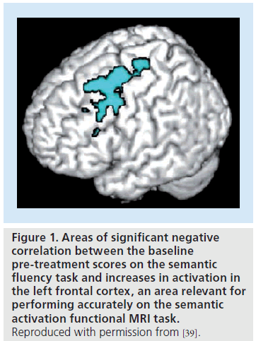 imaging-in-medicine-increases-activation