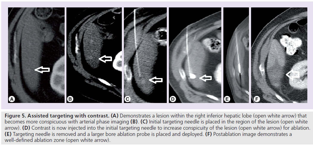 imaging-in-medicine-inferior-hepatic