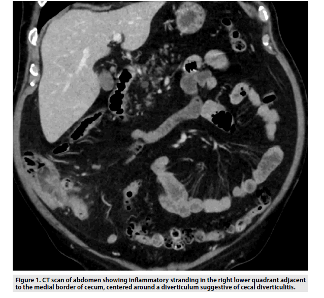 imaging-in-medicine-inflammatory