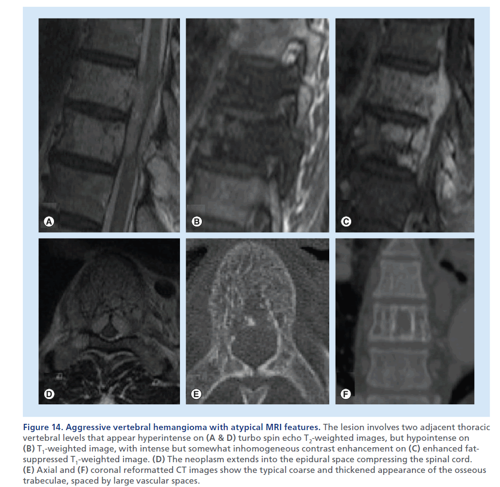 imaging-in-medicine-inhomogeneous–contrast