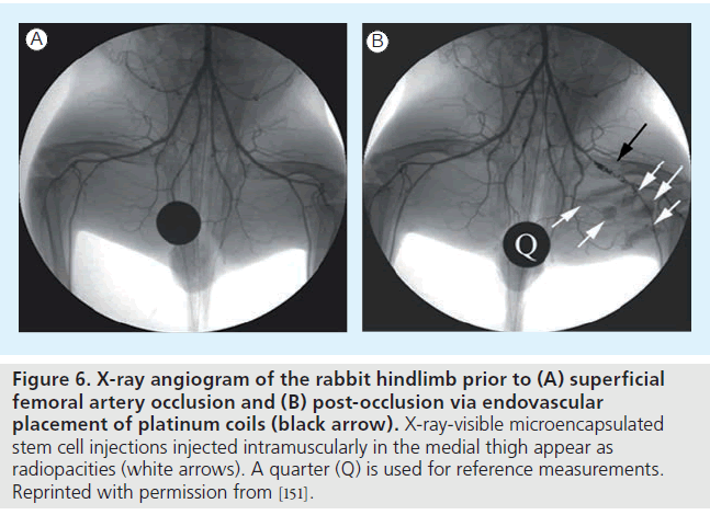 imaging-in-medicine-injected-intramuscularly