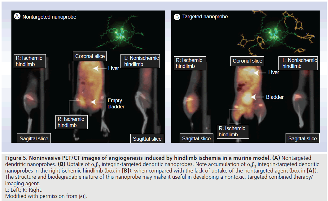 imaging-in-medicine-integrin-targeted