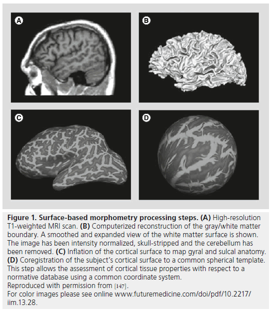 imaging-in-medicine-intensity-normalized