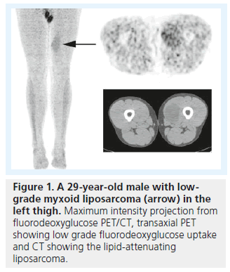 imaging-in-medicine-intensity-projection