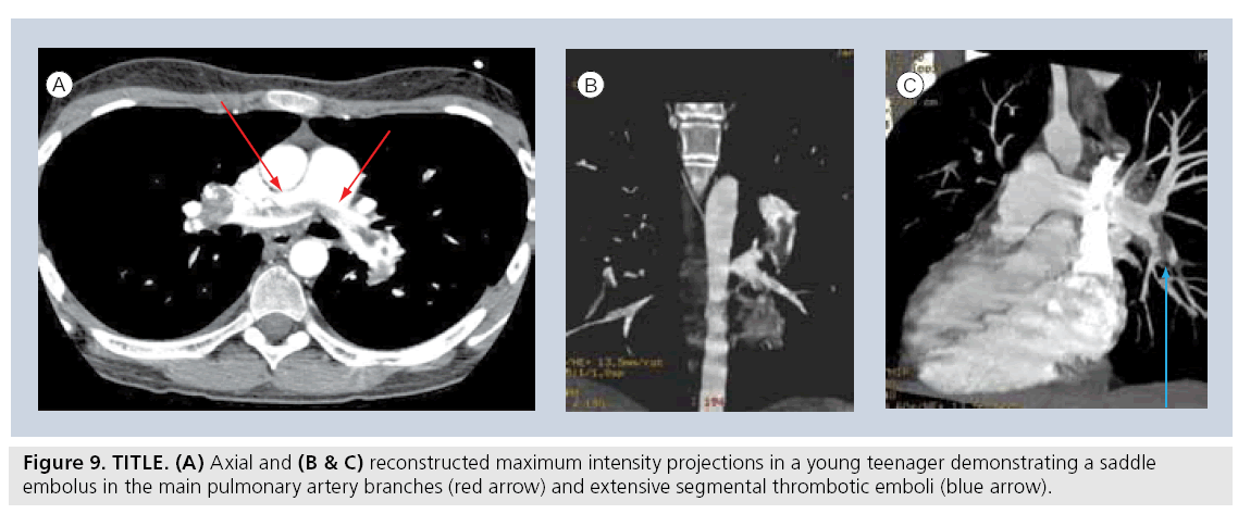 imaging-in-medicine-intensity-projections