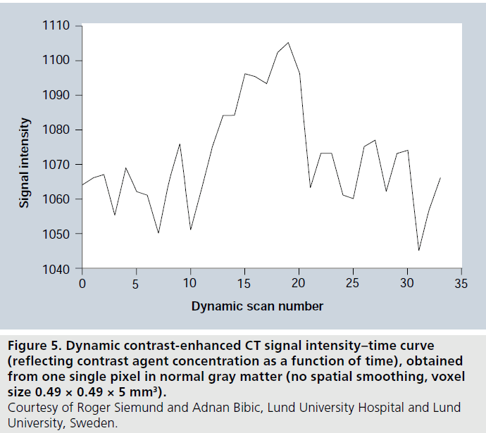 imaging-in-medicine-intensity-time