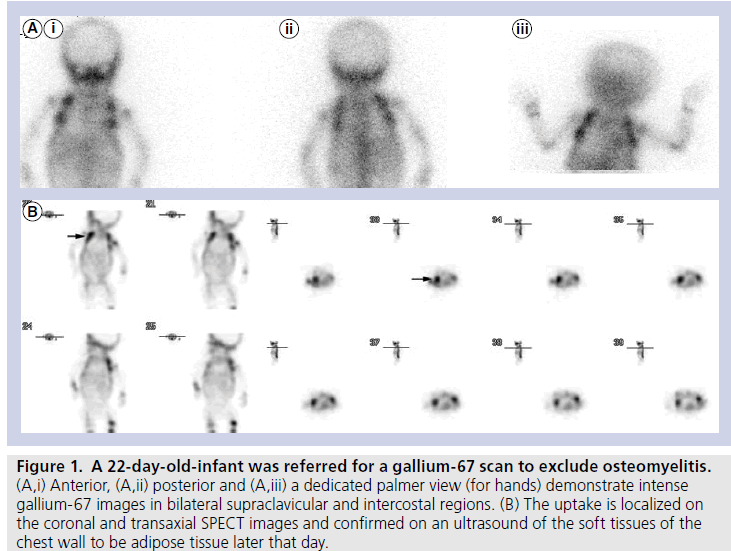 imaging-in-medicine-intercostal-regions