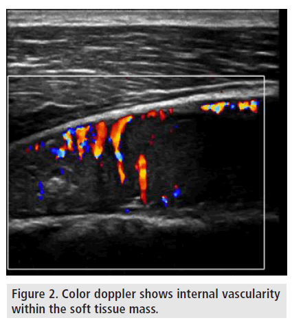 imaging-in-medicine-internal-vascularity