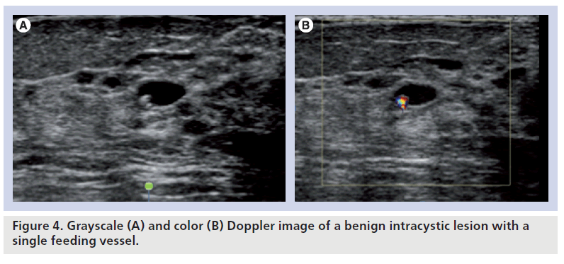 imaging-in-medicine-necrotic-tumor