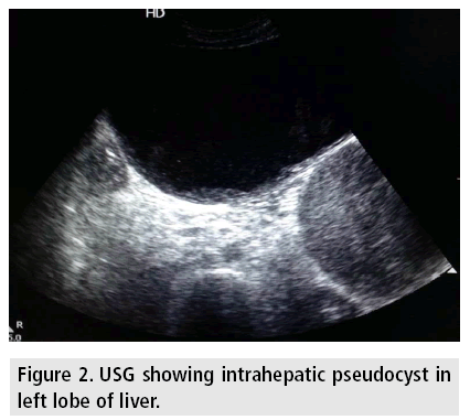 imaging-in-medicine-intrahepatic