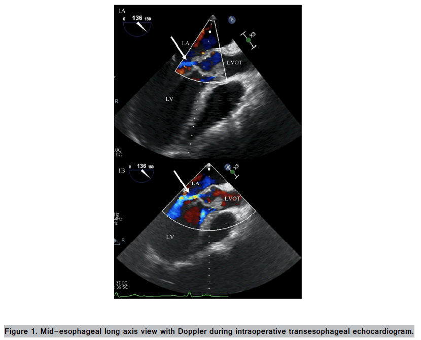 imaging-in-medicine-intraoperative-transesophageal