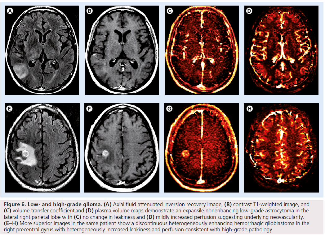 imaging-in-medicine-inversion-recovery