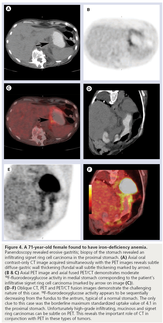 imaging-in-medicine-iron-deficiency