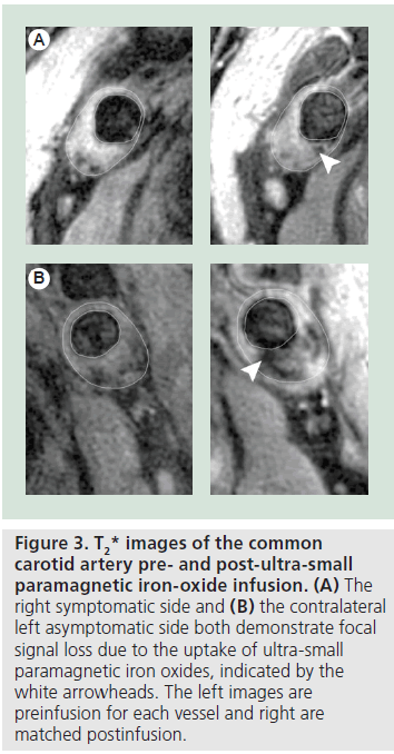 imaging-in-medicine-iron-oxide