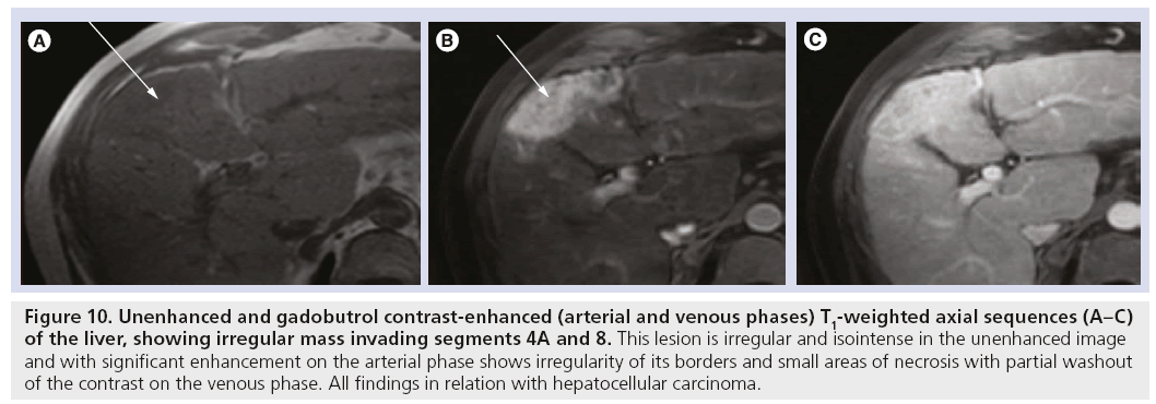 imaging-in-medicine-irregular-mass