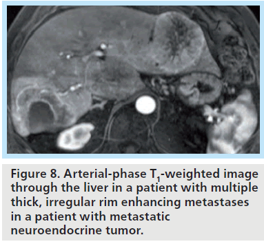 imaging-in-medicine-irregular-rim