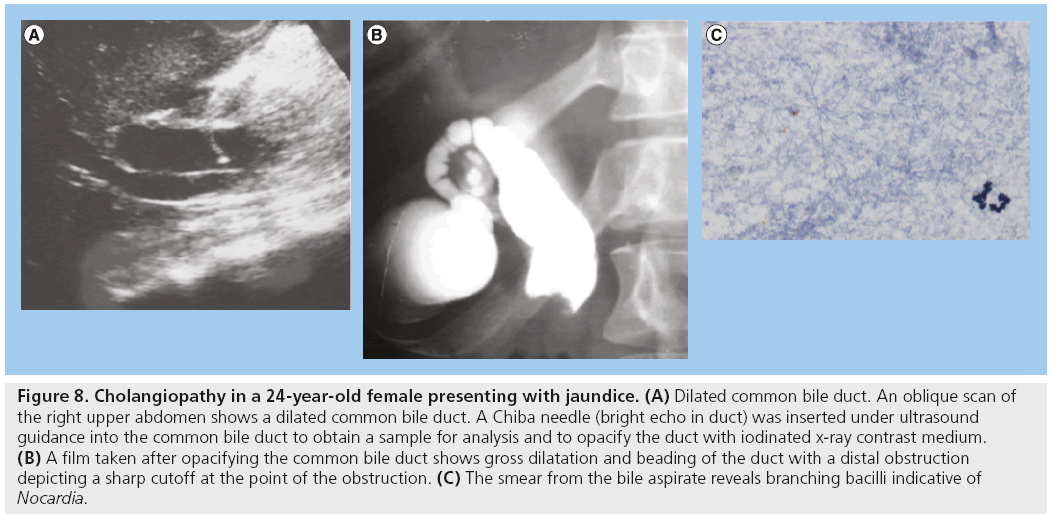 imaging-in-medicine-jaundice