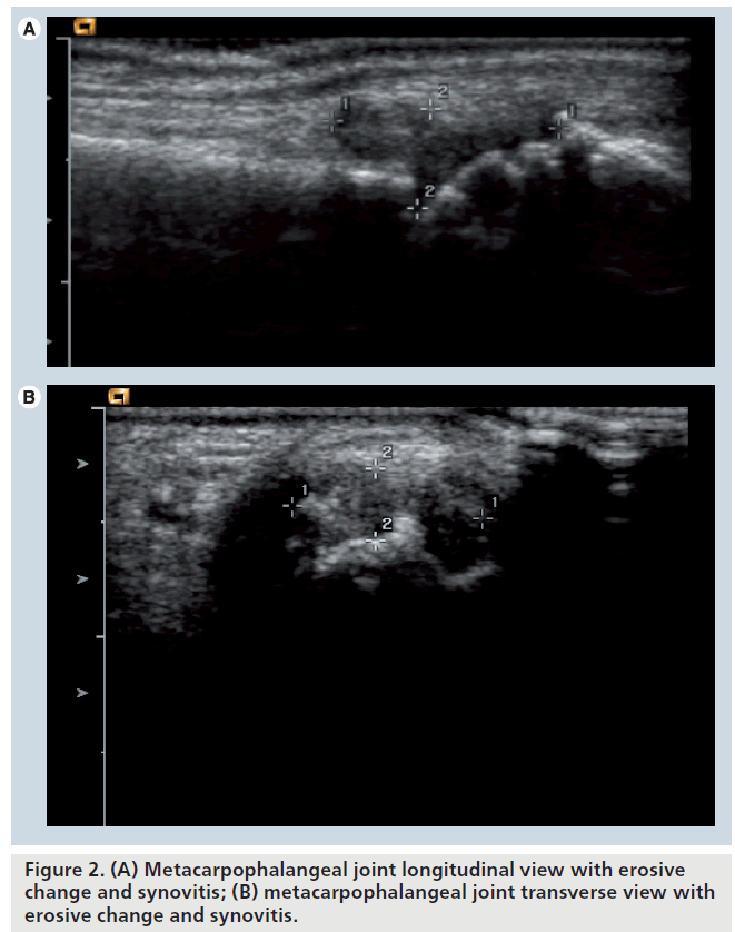 imaging-in-medicine-joint-longitudinal