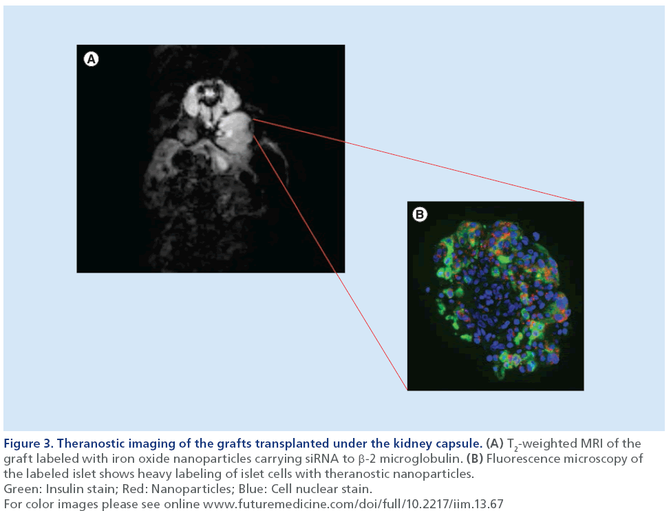 imaging-in-medicine-kidney-capsule