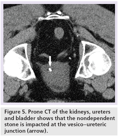 imaging-in-medicine-kidneys