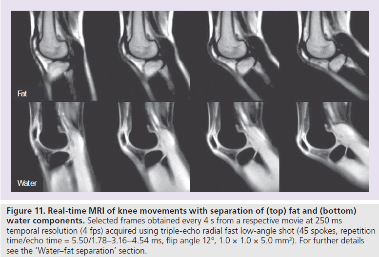 imaging-in-medicine-knee-movements