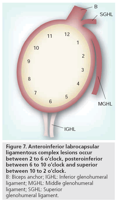 imaging-in-medicine-labrocapsular